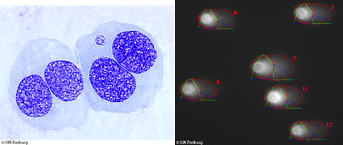 Untersuchung von DNA-Schäden in menschlichen Zellen nach Exposition mit Nanopartikeln. © IUK Freiburg