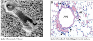 Querschnitte durch die Lunge (links) und eine Alveole (rechts) von Versuchstieren, die im Versuch Carbon Black Nanopartikel eingeatmet haben.